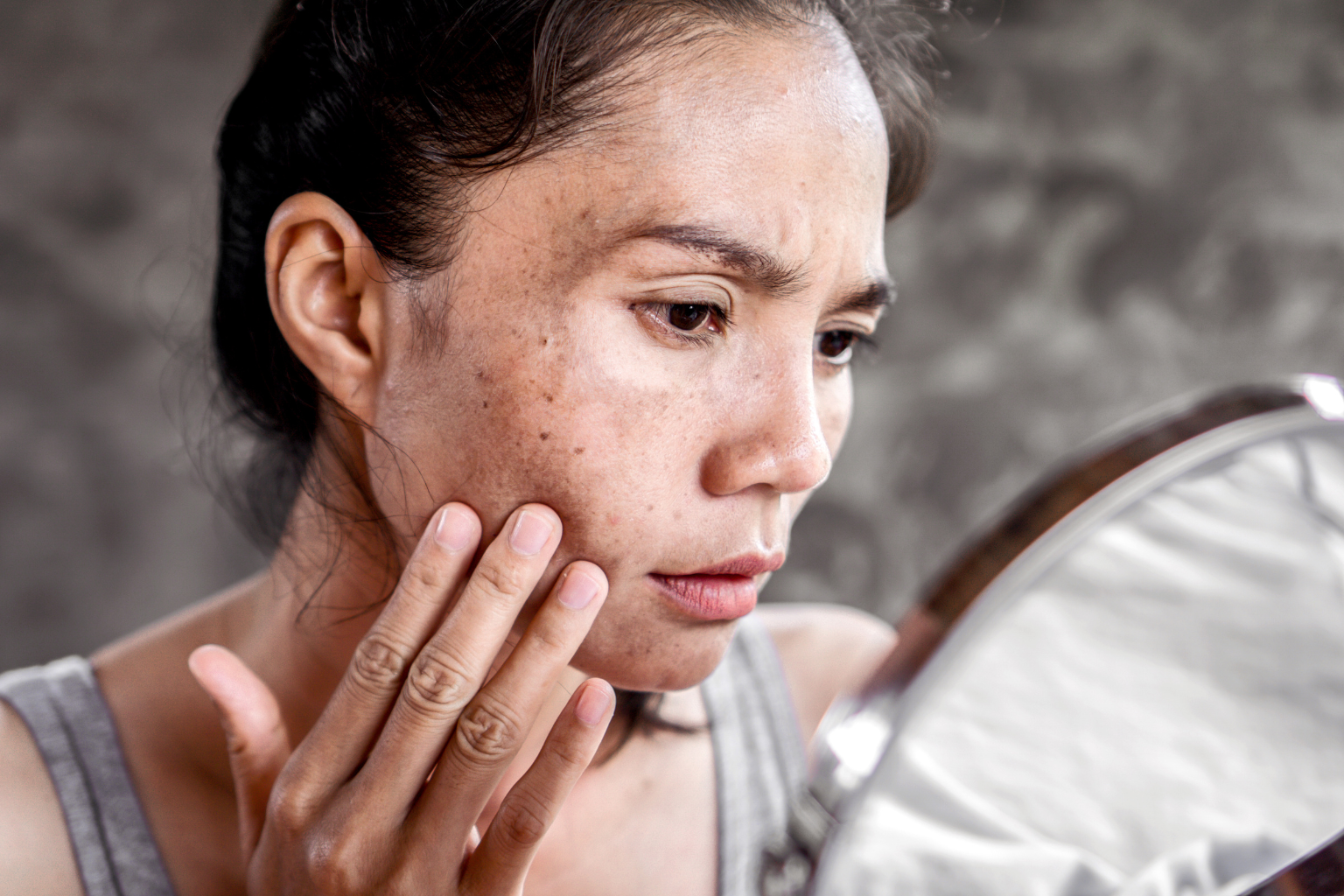 Summer Pigmentation Playbook: Prevent, Fade, Protect