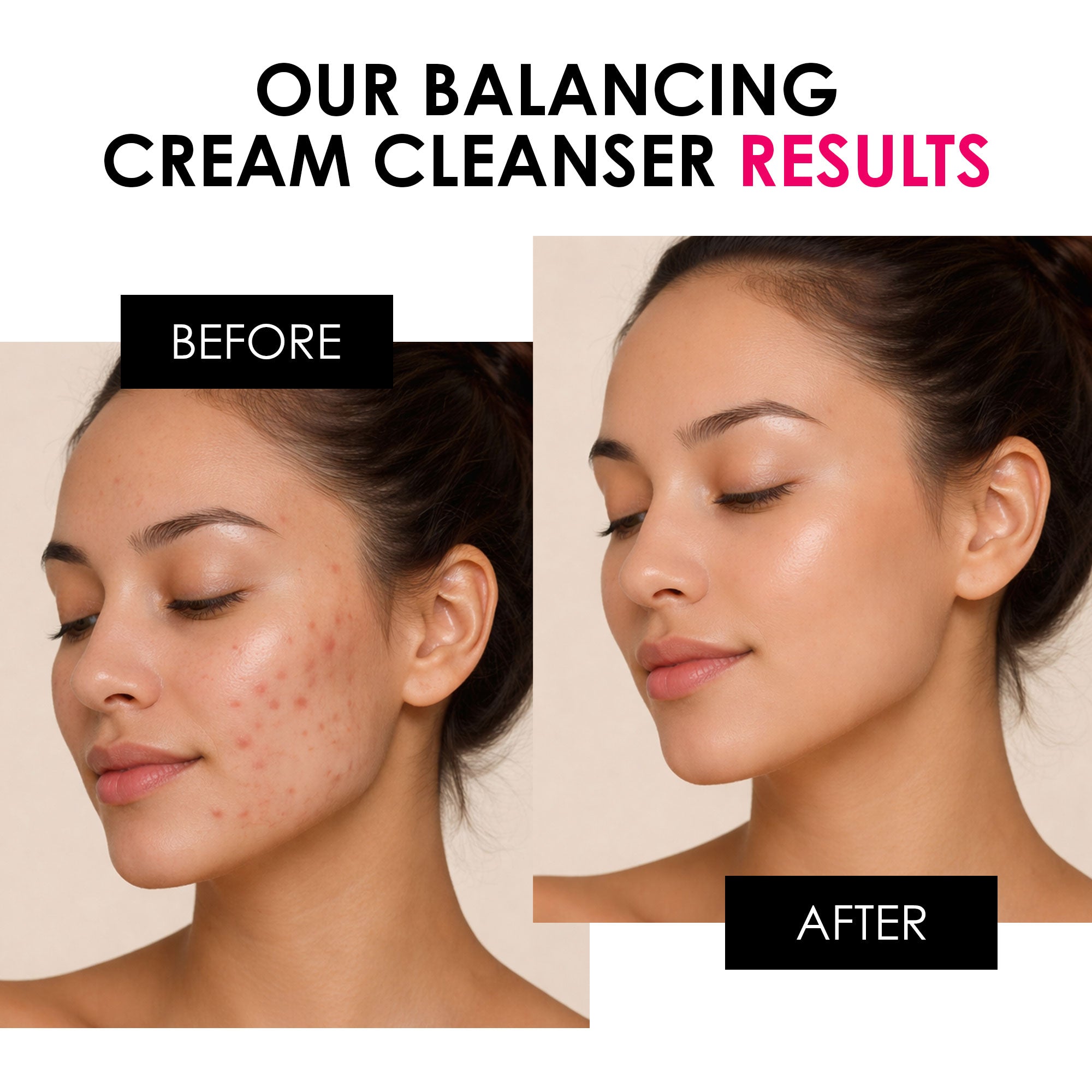 Balancing Vitamin C & Glycolic Acid Cream Cleanser 200ml - skinChemists