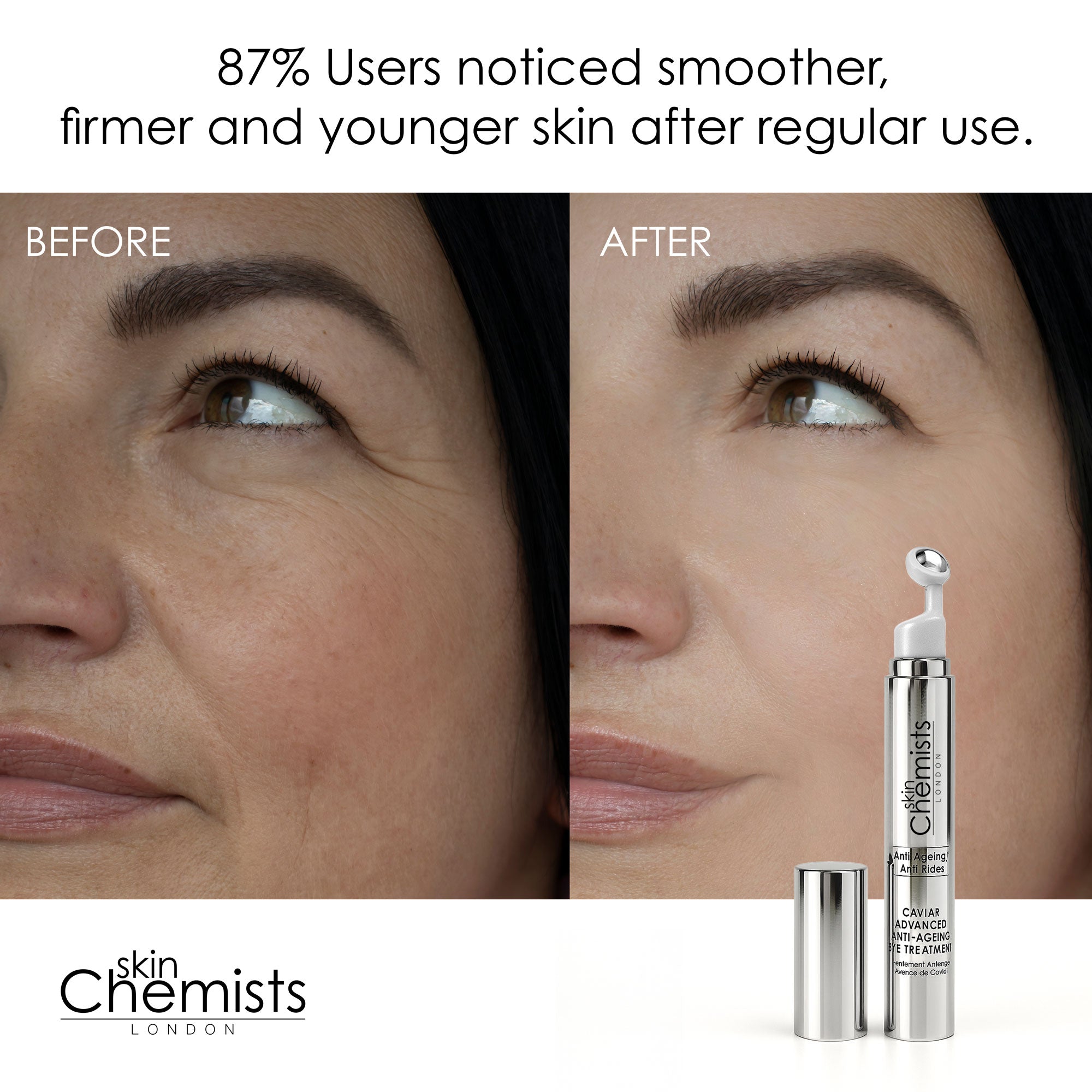 Caviar Advanced Anti-Ageing Eye Treatment 15ml - skinChemists