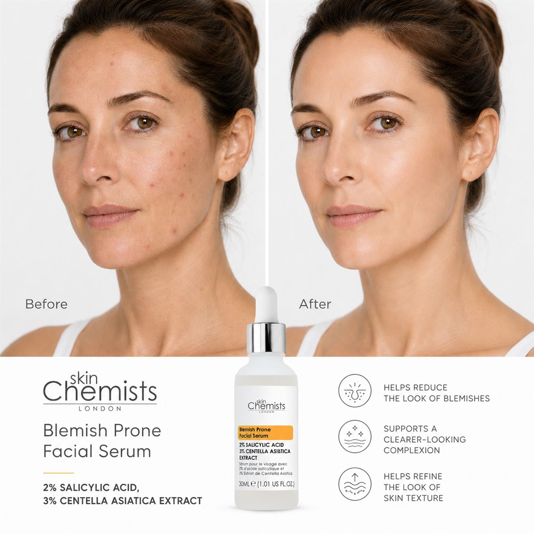 skinChemists Acne Prone Serum Salicylic Acid 2%, Centella Asistica 3% 30ml