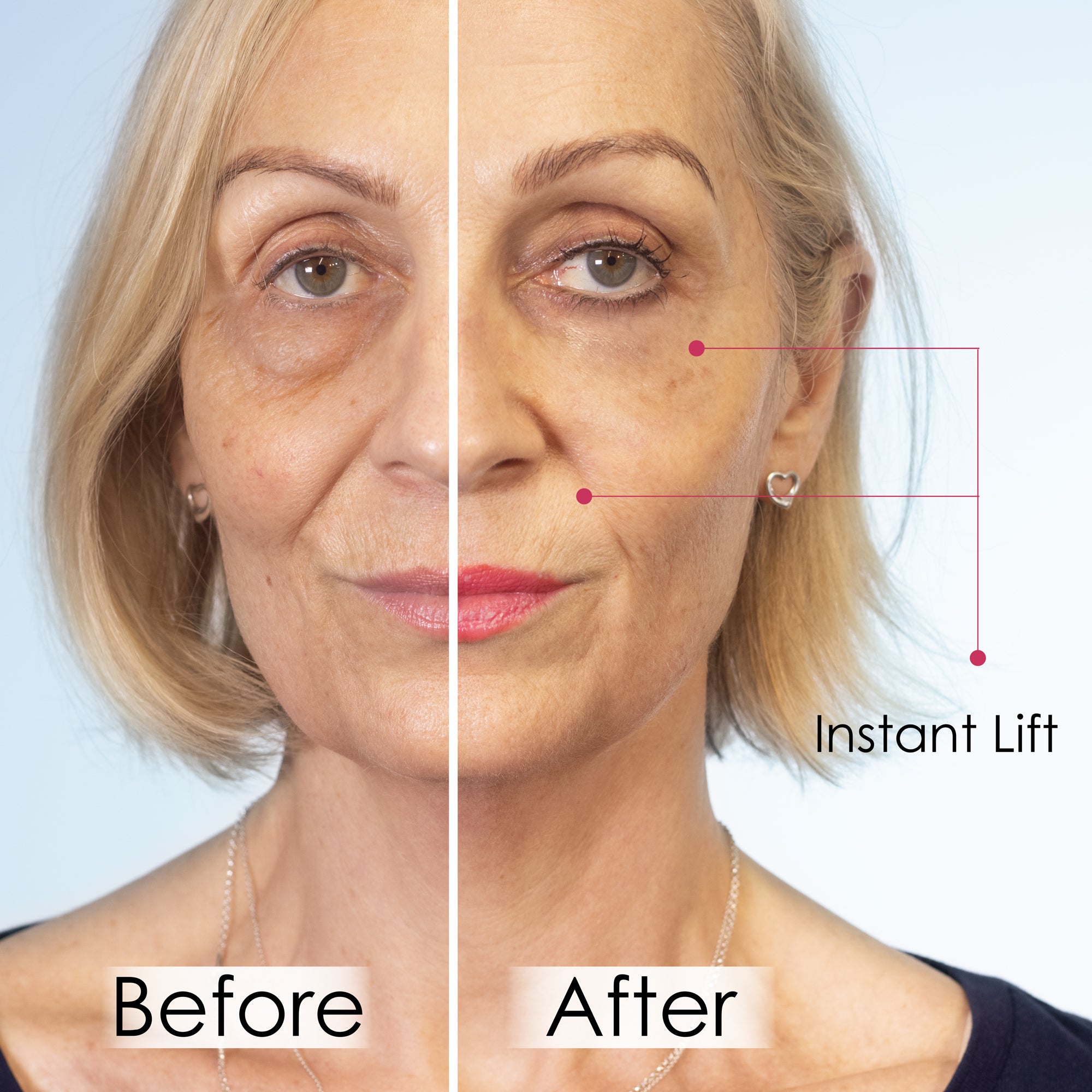 Wrinkle Killer Instant Lift with Hyaluronic Acid & Peptides - skinChemists