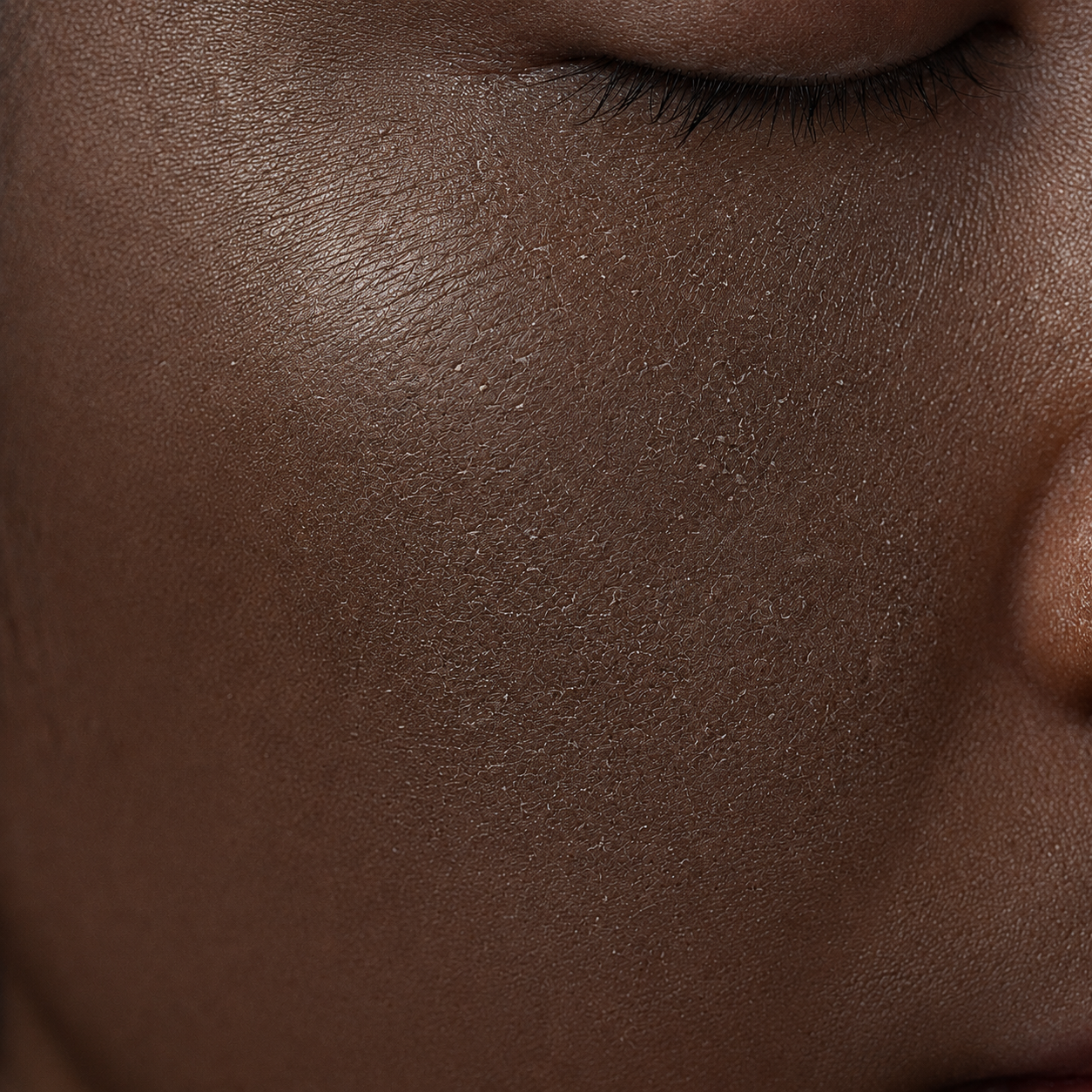 Concern: Dryness & Dehydration