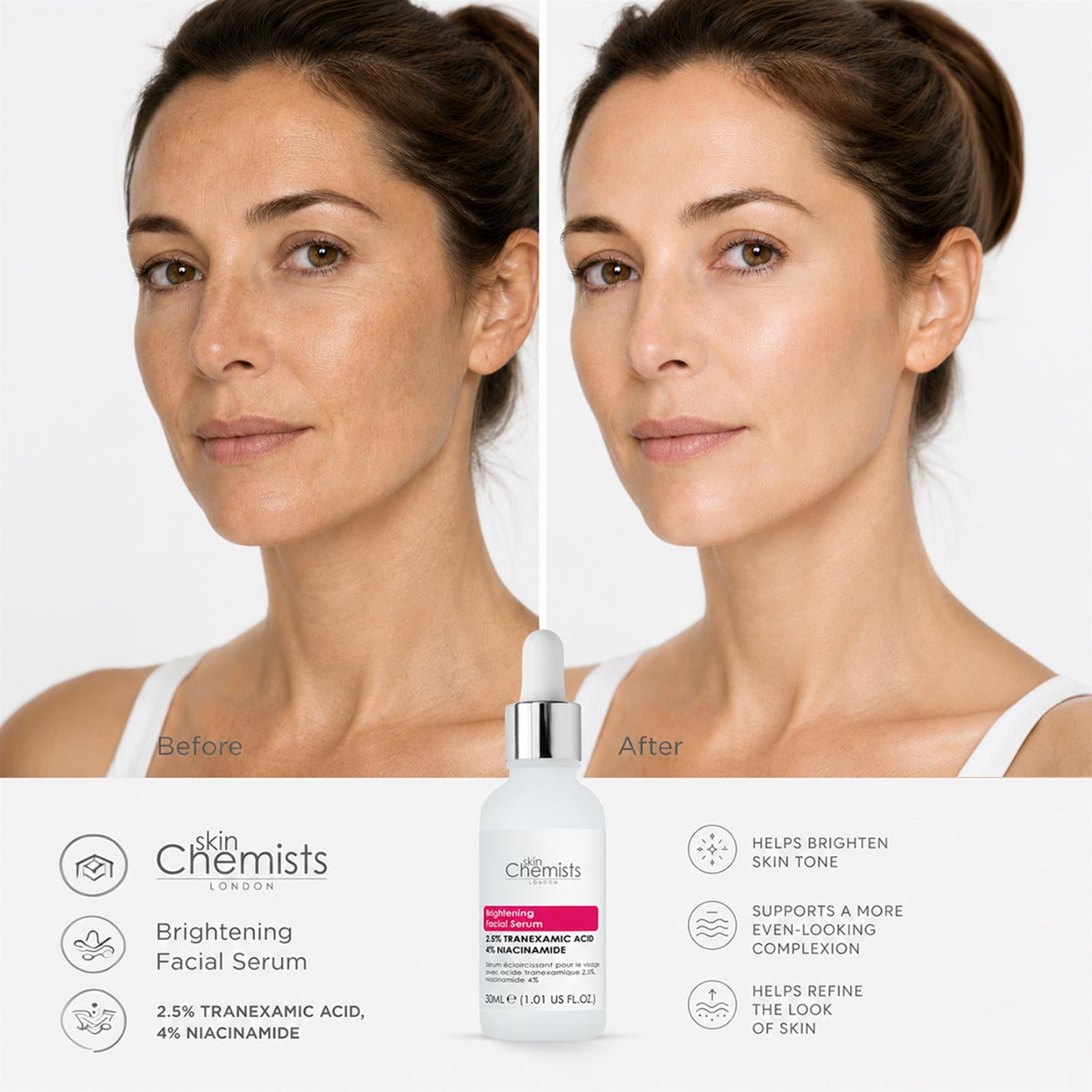 skinChemists Brightening Facial Serum with Tranexamic Acid 2.5% and Niacinamide 4% 30ml