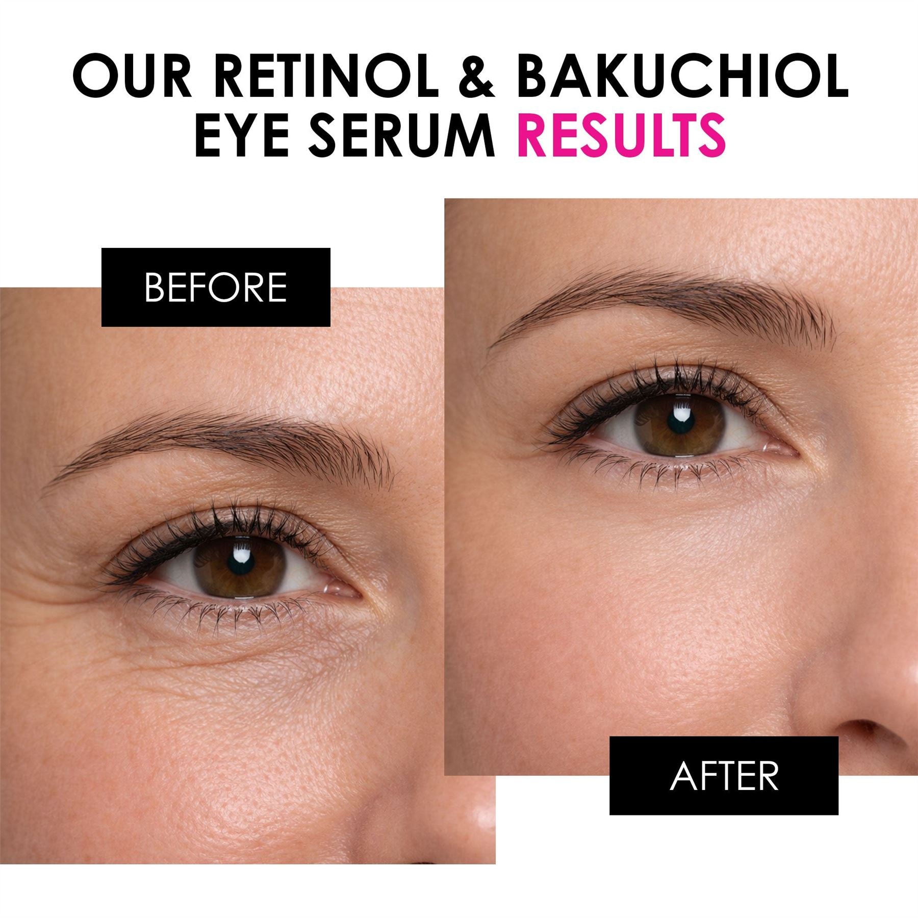 Retinol & Bakuchiol Eye Serum 15ml - skinChemists