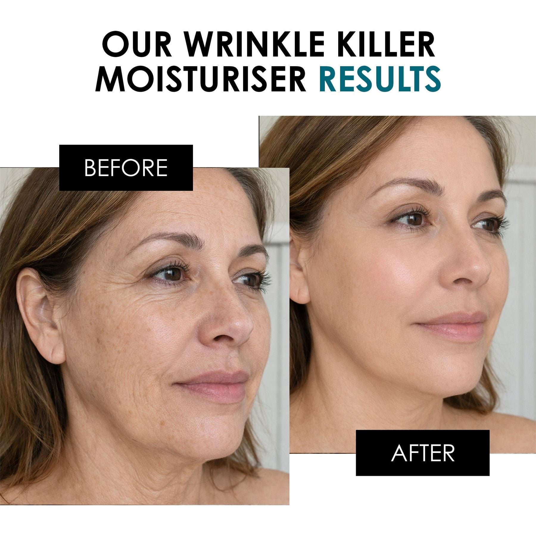 SC Wrinkle Killer SFP50 Duo Moisturiser 50ml