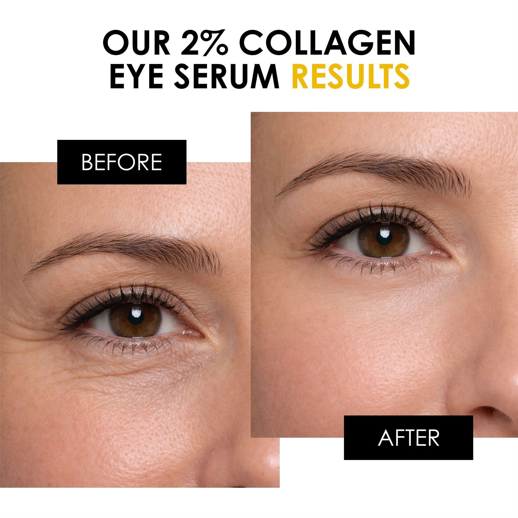 2% Collagen Eye Serum 15ml (Vegan) - skinChemists
